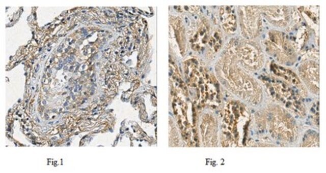 抗-PTK7抗体（克隆4F9） ascites fluid, clone 4F9, from mouse