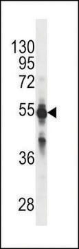 MONOCLONAL ANTI-CYP2C9 (N-TERMINAL) antibody produced in mouse crude ascites, buffered aqueous solution