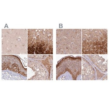 抗HAL抗体 ウサギ宿主抗体 Prestige Antibodies&#174; Powered by Atlas Antibodies, affinity isolated antibody, buffered aqueous glycerol solution