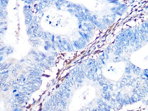 Anti-Galectin 1/LGALS1 antibody produced in rabbit