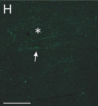 Anti-Chondroitin-Sulfat-Proteoglykan-Antikörper, Gehirn (Kernprotein), Klon Cat-301 clone Cat-301, Chemicon&#174;, from mouse