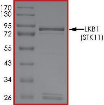 LKB1(STK11) Protein recombinant