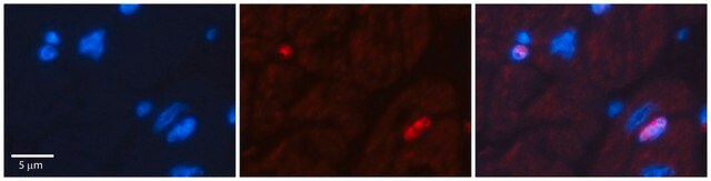 Anti-DPF3 antibody produced in rabbit affinity isolated antibody