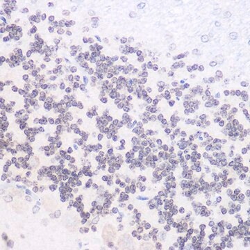 Anti-Phospho-NF-kB p65/RelA-S536 antibody produced in rabbit