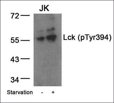 抗-磷酸-LCK (pTyr394) 兔抗 affinity isolated antibody