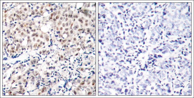 Anti-phospho-CDKN1B (pThr187) antibody produced in rabbit affinity isolated antibody