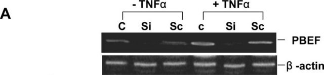 Anti-&#946;-Actin antibody, Mouse monoclonal clone AC-15, purified from hybridoma cell culture