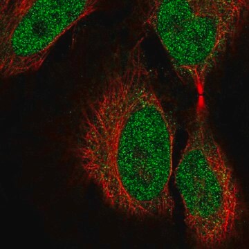 Anti-COL9A3 antibody produced in rabbit Prestige Antibodies&#174; Powered by Atlas Antibodies, affinity isolated antibody