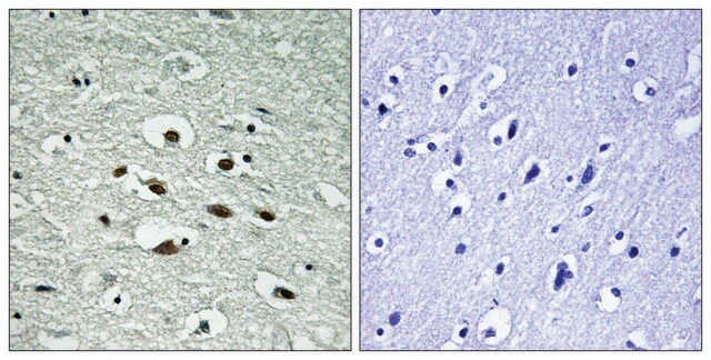 Anti-phospho-Chk1 (pSer296) antibody produced in rabbit affinity isolated antibody