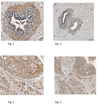 Anti-Anoctamin-1/TMEM16A Antibody, clone 5F8.1 clone 5F8.1, from mouse