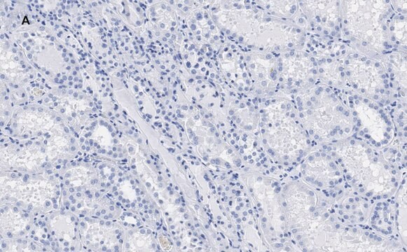 Anti-c-Myc Antibody, clone 7E18, ZooMAb&#174; Rabbit Monoclonal recombinant, expressed in HEK 293 cells