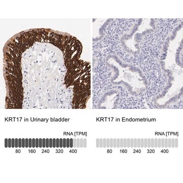 抗JUP ウサギ宿主抗体 Ab2, Prestige Antibodies&#174; Powered by Atlas Antibodies, affinity isolated antibody, buffered aqueous glycerol solution