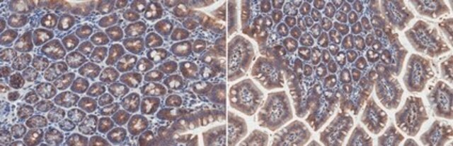 Anti-Cytokeratin-20 Antibody, clone XQ1 clone XQ1, from mouse