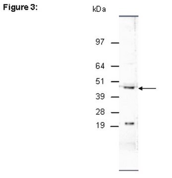 ChIPAb+ JMJD1C - ChIP Validated Antibody and Primer Set from rabbit, purified by affinity chromatography