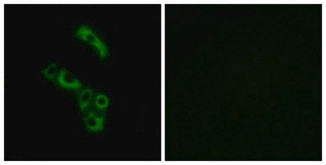 Anti-C1QB, C-Terminal antibody produced in rabbit affinity isolated antibody