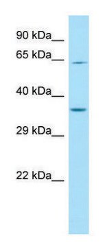 Anti-IL4I1 (C-terminal) antibody produced in rabbit affinity isolated antibody