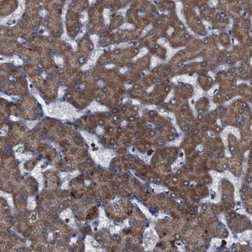 Anti-ATP7B antibody produced in rabbit Prestige Antibodies&#174; Powered by Atlas Antibodies, affinity isolated antibody, buffered aqueous glycerol solution