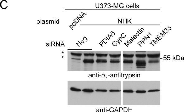 抗 &#945; 1 -抗胰蛋白酶 兔抗 IgG fraction of antiserum