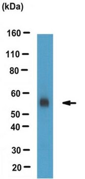 Anti-ACAT-2 Antibody from rabbit, purified by affinity chromatography