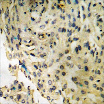 Anti-phospho-IRF-3 (pSer386) antibody produced in rabbit affinity isolated antibody