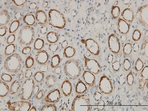 Monoclonal Anti-ACAA2 antibody produced in mouse clone 5C4, purified immunoglobulin, buffered aqueous solution