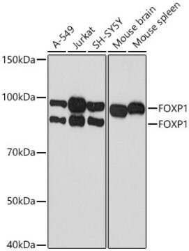 Anti-FOXP1 Antibody, clone 2Q1R5, Rabbit Monoclonal