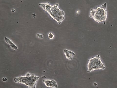 INS-1E Rat Insulinoma Beta Cell Line