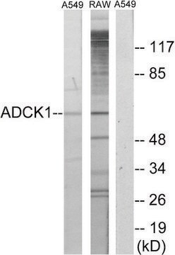 Anti-ADCK1 antibody produced in rabbit affinity isolated antibody