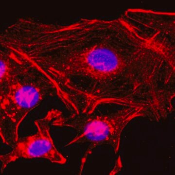 Anti-beta-Actin antibody, Rabbit monoclonal recombinant, expressed in HEK 293 cells, clone RM112, purified immunoglobulin