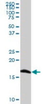 抗SOD1抗体 マウス宿主抗体 purified immunoglobulin, buffered aqueous solution