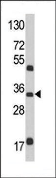 ANTI-M6PR(N-TERMINAL) antibody produced in rabbit purified immunoglobulin, buffered aqueous solution