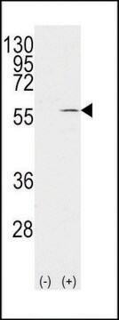 ANTI-VIMENTIN (S82) antibody produced in rabbit affinity isolated antibody, buffered aqueous solution