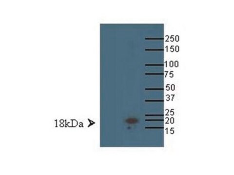 Anti-LMO4 Antibody Chemicon&#174;, from rabbit