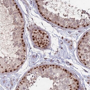 Anti-TRMT6 antibody produced in rabbit Prestige Antibodies&#174; Powered by Atlas Antibodies, affinity isolated antibody, buffered aqueous glycerol solution