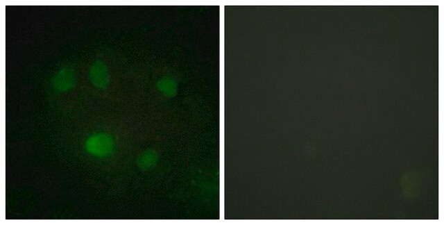 Anti-DDX5 antibody produced in rabbit affinity isolated antibody