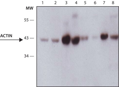 Anti-Actin, Muscle specific antibody, Mouse monoclonal clone HHF-35, purified from hybridoma cell culture