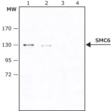 Anti-SMC6 in Kaninchen hergestellte Antikörper IgG fraction of antiserum, buffered aqueous solution