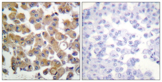 Anti-TGF &#946;1 antibody produced in rabbit affinity isolated antibody