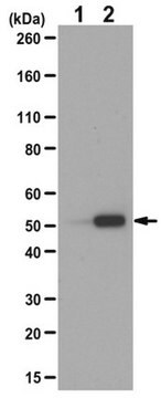 Anticorps anti-acétyl-tubuline&nbsp;(Lys40) from rabbit, purified by affinity chromatography