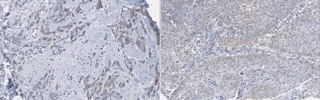 Anti-LATS1 Antibody, clone 9A3.1 clone 9A3.1, from mouse