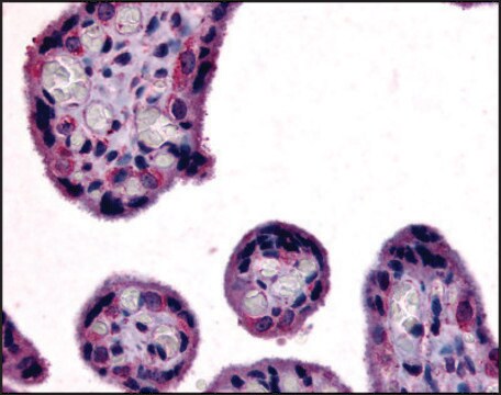 Anti-SLC7A5 (AB1) antibody produced in rabbit affinity isolated antibody, buffered aqueous solution