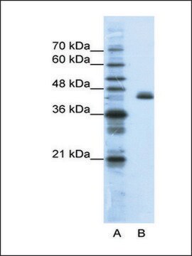 抗ZFP36L2抗体 ウサギ宿主抗体 IgG fraction of antiserum