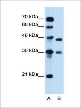 抗MPG抗体 ウサギ宿主抗体 affinity isolated antibody