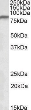 Anti-NDUFS1 antibody produced in goat affinity isolated antibody, buffered aqueous solution