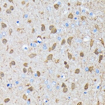 Anti-PGP9.5/UCHL1 antibody produced in rabbit