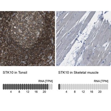 Anti-STK10 antibody produced in rabbit Prestige Antibodies&#174; Powered by Atlas Antibodies, affinity isolated antibody, buffered aqueous glycerol solution