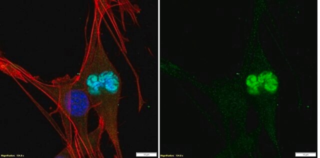 Anti-Phospho-Histon-H3(Thr3)-Antikörper Upstate&#174;, from rabbit