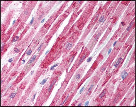 Anti-TANK (AB1) antibody produced in rabbit affinity isolated antibody, buffered aqueous solution