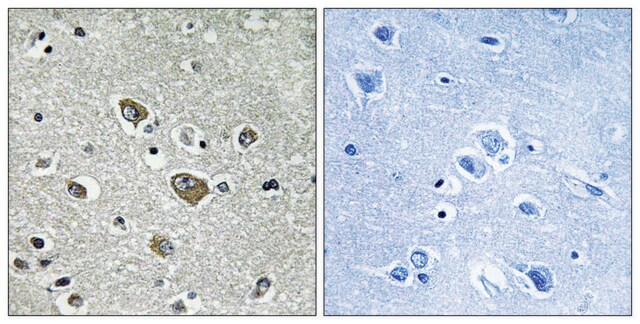 Anti-ZDHHC9 antibody produced in rabbit affinity isolated antibody