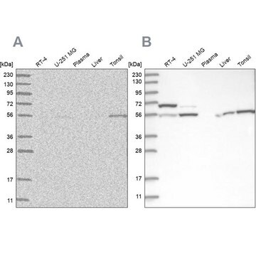 Anti-PPM1F antibody produced in rabbit Prestige Antibodies&#174; Powered by Atlas Antibodies, affinity isolated antibody, buffered aqueous glycerol solution